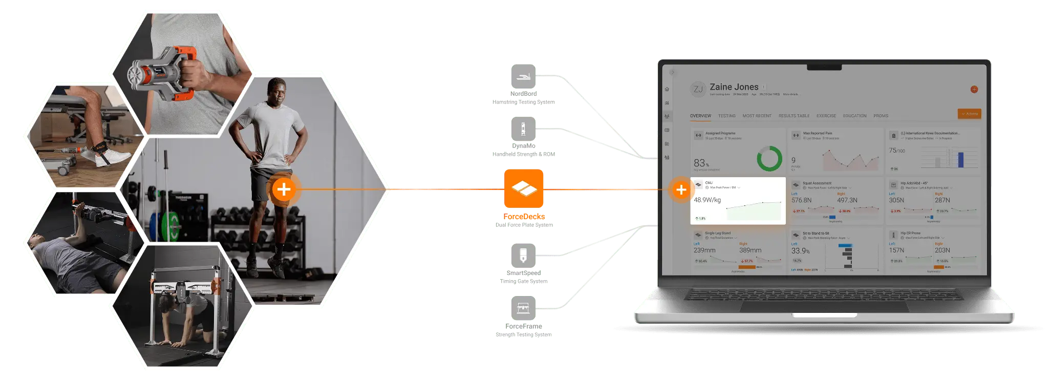 Applications and visualizations of the systems Martin and his team adopted from VALD.
